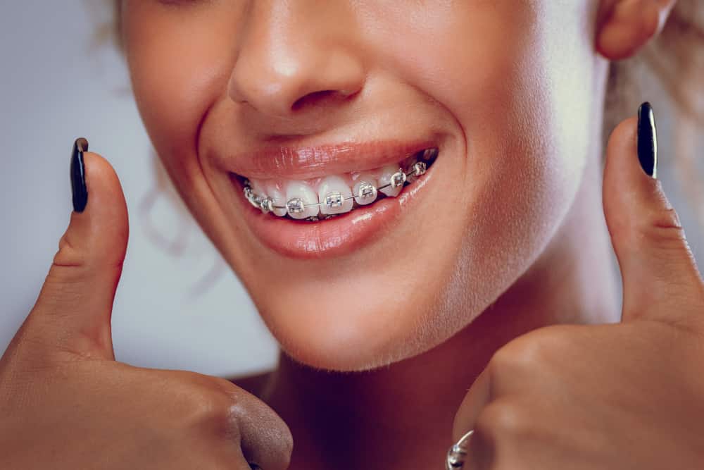 Orthodontics: Everything You Need to Know