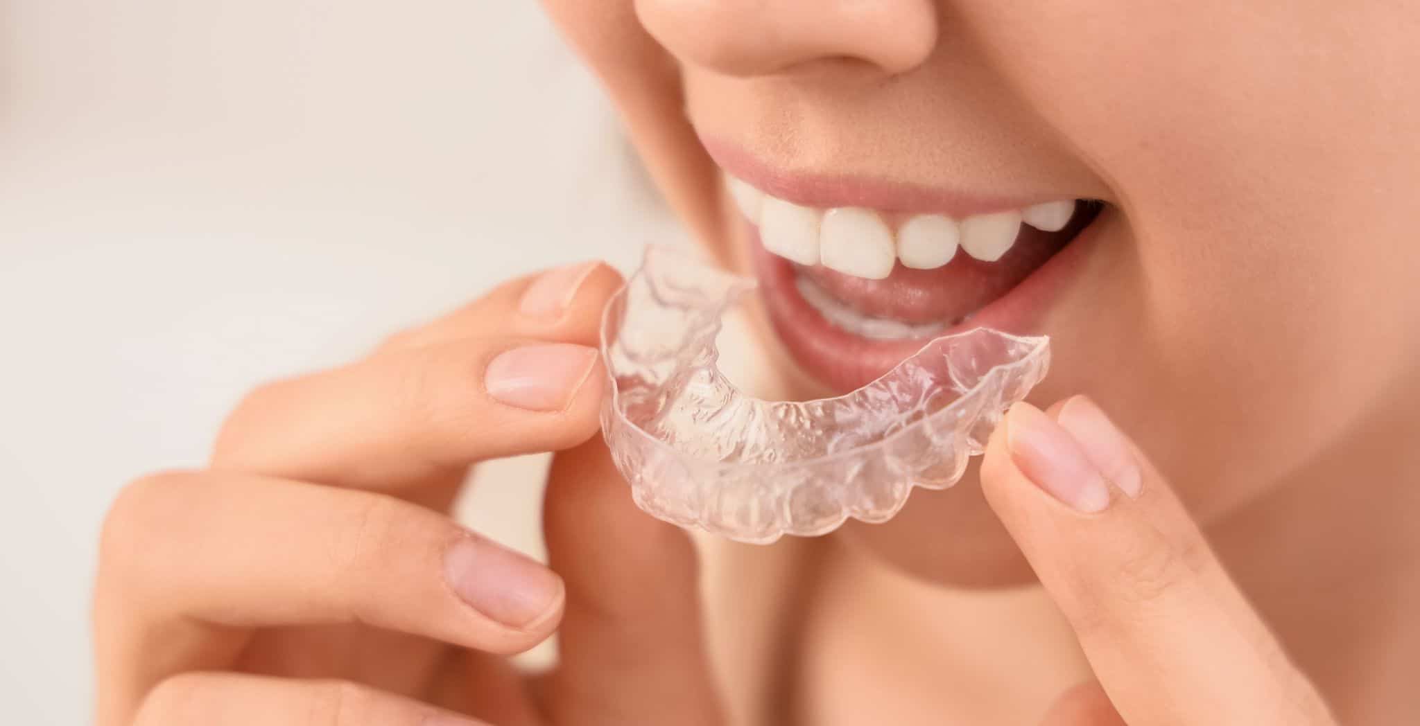 Bite splint vs night guard, Difference between bite splint and night guard, Bite splint for teeth grinding, Night guard for bruxism, Bite splint dental appliance, Night guard dental device, Bite splint for TMJ disorder, Night guard vs bite guard, Bite splint benefits, Night guard benefits, Bite splint vs night guard cost, Bite splint for jaw pain, Night guard for teeth clenching, Dental splint vs mouth guard, Bite splint vs night guard comparison